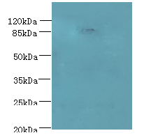 PASD1 Polyclonal Antibody