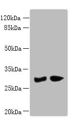 PBLD Polyclonal Antibody (100 µl)