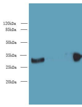 PBLD Polyclonal Antibody