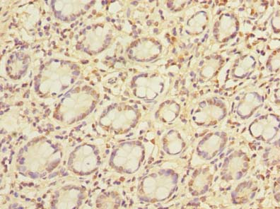 PCIF1 Polyclonal Antibody