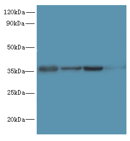 PDCD1 Polyclonal Antibody