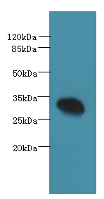 PDCL2 Polyclonal Antibody