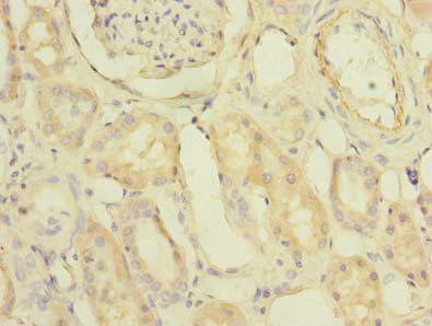 Immunohistochemistry of paraffin-embedded human kidney tissue using PDCL2 Polyclonal Antibody at dilution of 1:100