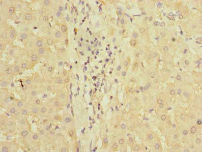 Immunohistochemistry of paraffin-embedded human liver tissue using PDCL2 Polyclonal Antibody at dilution of 1:100