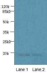 PDE6D Polyclonal Antibody