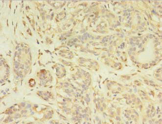 PDGFRB Polyclonal Antibody