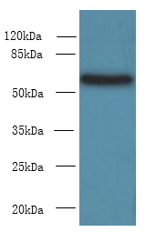 PDIA5 Polyclonal Antibody