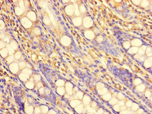 PDIK1L Polyclonal Antibody