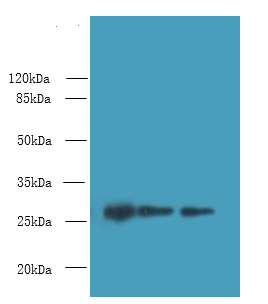 PEX11B Polyclonal Antibody