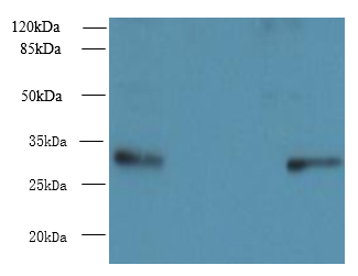 PIH1D1 Polyclonal Antibody
