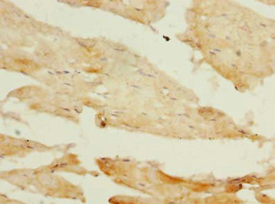 PIK3R1 Polyclonal Antibody