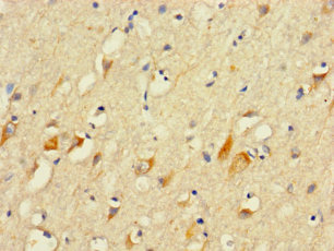 PLCL2 Polyclonal Antibody