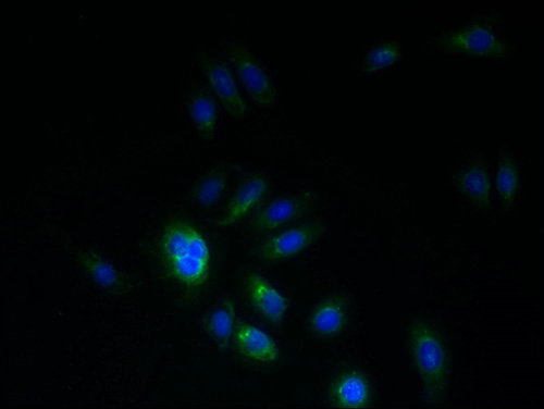 PMP22 Polyclonal Antibody