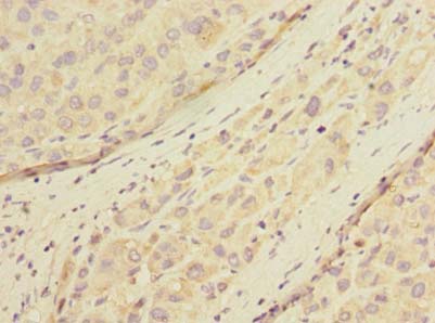 POMGNT1 Polyclonal Antibody