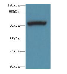 PORCN Polyclonal Antibody