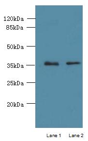 PLPP2 Polyclonal Antibody