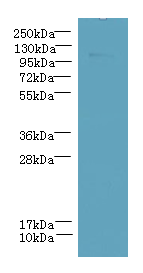 Western blot<br />All lanes: PPFIBP2 Polyclonal Antibody at 6ug/ml+ HepG-2 whole cell lysate<br />Goat polyclonal to rabbit at 1/10000 dilution<br />Predicted band size: 99 kDa <br />Observed band size: 99 kDa <br />