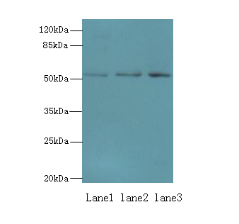 PPP2R2B Polyclonal Antibody