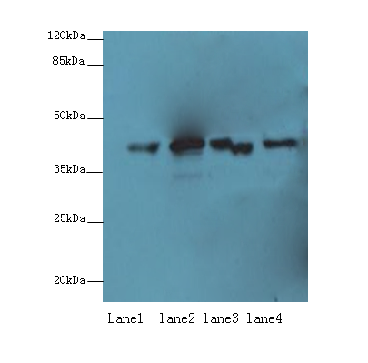 PPP2R4 Polyclonal Antibody