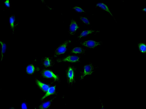 PQLC2 Polyclonal Antibody