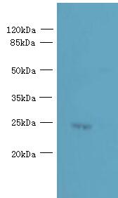 PQLC3 Polyclonal Antibody