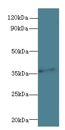 PRPSAP1 Polyclonal Antibody