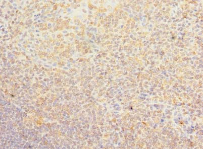 PSD4 Polyclonal Antibody