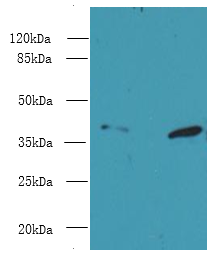 PSMD7 Polyclonal Antibody