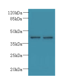 PSTPIP2 Polyclonal Antibody