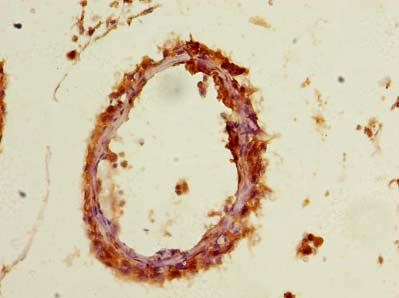 PYCR2 Polyclonal Antibody