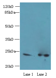 RAB11B Polyclonal Antibody