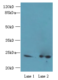 Western blot<br />All lanes: RAB11B Polyclonal Antibody at 2ug/ml<br />Lane 1: hela cells; Lane 2: rat gonad tissue<br />Secondary<br />Goat polyclonal to rabbit at 1/10000 dilution<br />Predicted band size: 24kDa <br />Observed band size: 24kDa <br />