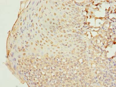 RAB33A Polyclonal Antibody