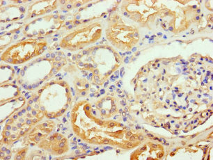 RAB35 Polyclonal Antibody