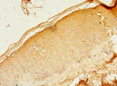 RAB37 Polyclonal Antibody