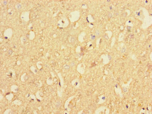 RAB40B Polyclonal Antibody