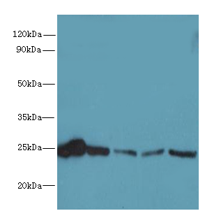 RAB6B Polyclonal Antibody