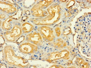 RABGGTA Polyclonal Antibody
