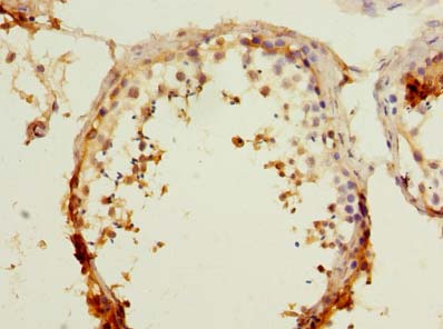 RAPGEF5 Polyclonal Antibody