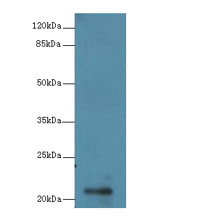 RBBP9 Polyclonal Antibody
