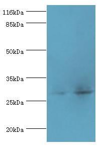 RBKS Polyclonal Antibody