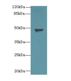RBM41 Polyclonal Antibody