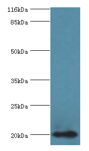 RBP5 Polyclonal Antibody
