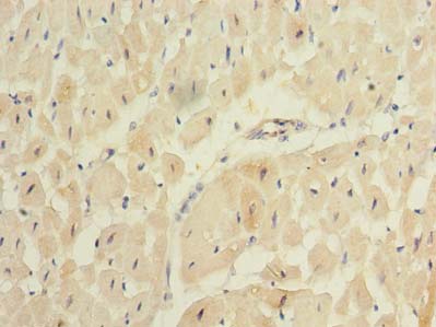 Immunohistochemistry of paraffin-embedded human heart tissue using REEP2 Polyclonal Antibody at dilution of 1:100