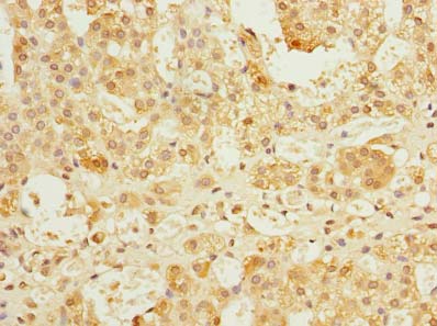 Immunohistochemistry of paraffin-embedded human adrenal gland tissue using REEP4 Polyclonal Antibody at dilution of 1:100