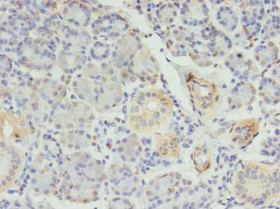 RFX6 Polyclonal Antibody