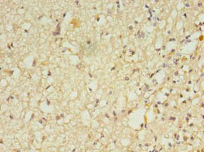 RGS7 Polyclonal Antibody
