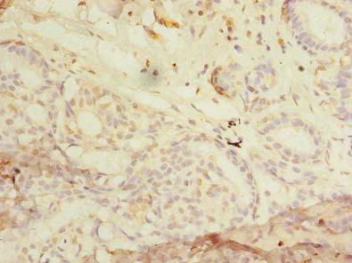 RHOC Polyclonal Antibody
