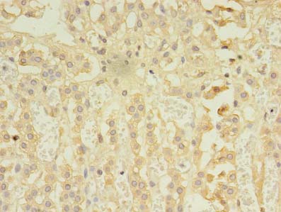RIPK3 Polyclonal Antibody