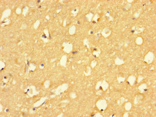 RIT2 Polyclonal Antibody